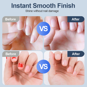 Universal Automatic Fingernail Grinder – Safe Electric Nail Trimmer for Adults & Children